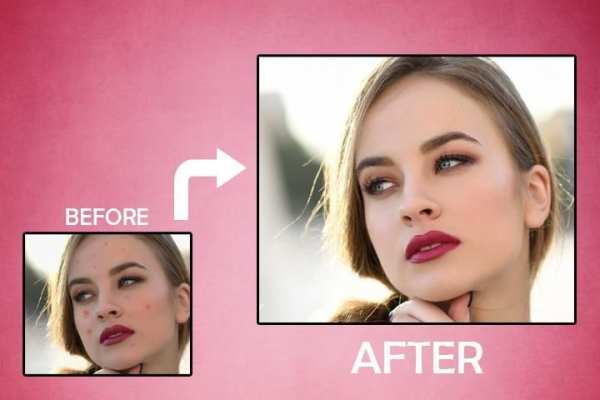 Acne Remover Zit remover Pimple Eraser 2 تصوير الشاشة