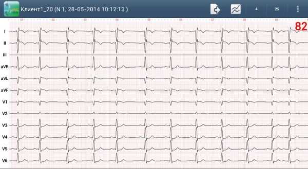 Easy ECG Mobile PRO screenshot 5