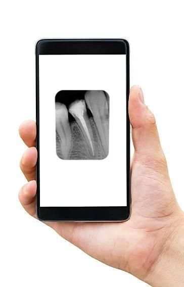 Dent.IN X-RAY screenshot 2