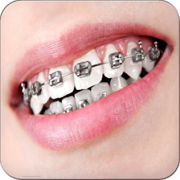 ikon Real Braces Teeth Booth Pro