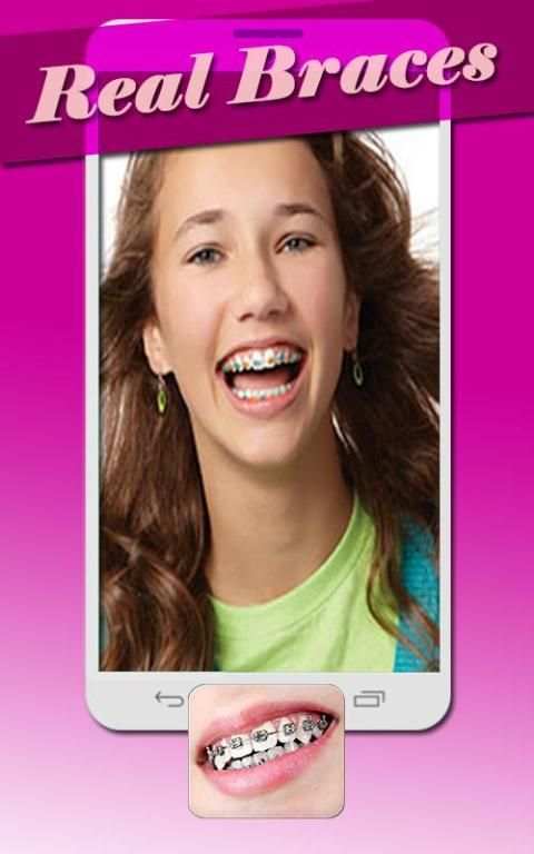 Real Braces Teeth Booth Pro 6 تصوير الشاشة