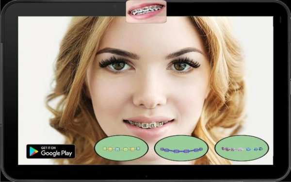 Real Braces Teeth Booth Pro 1 تصوير الشاشة