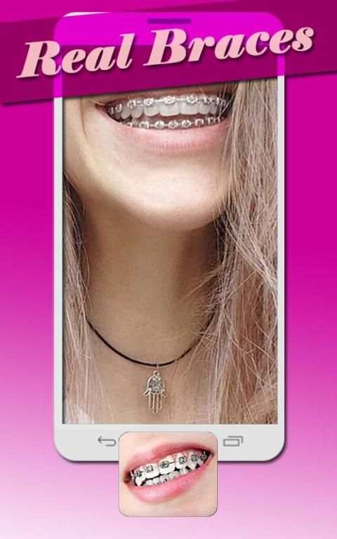 Real Braces Teeth Booth Pro 4 تصوير الشاشة
