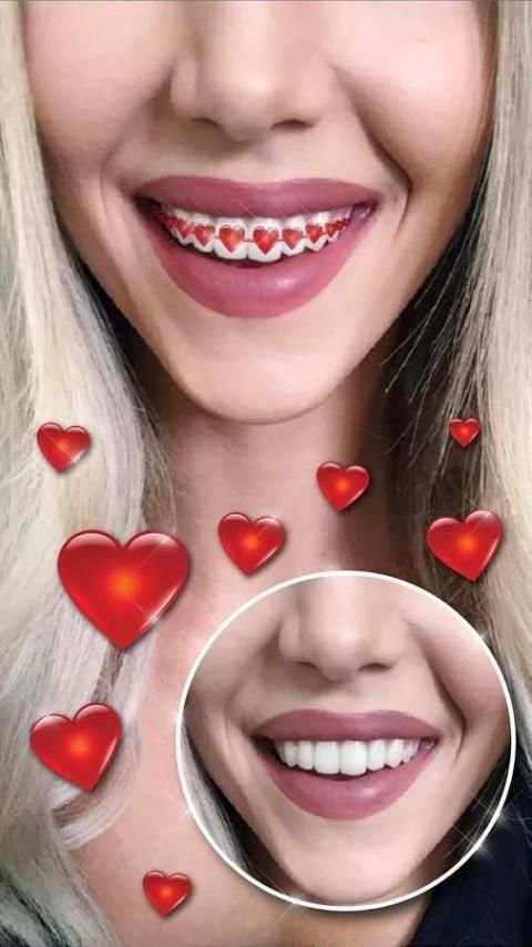 Braces Teeth Booth Camera App screenshot 8