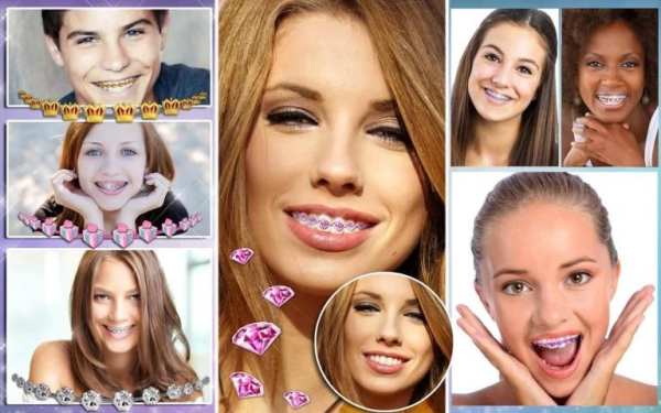 Braces Teeth Booth Camera App screenshot 1