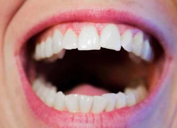 Mouth Ulcers Cure screenshot 1