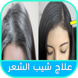 ikon افضل علاج الشيب في يومين