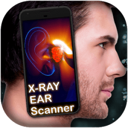 ikon X-ray Ear scanner Prank