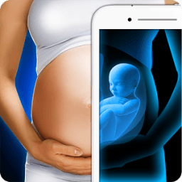 ikon Scanner X-Ray Ultrasound Prank