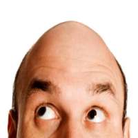 Baldness Treatments