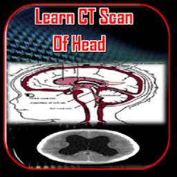 Learn CT Scan Of Head