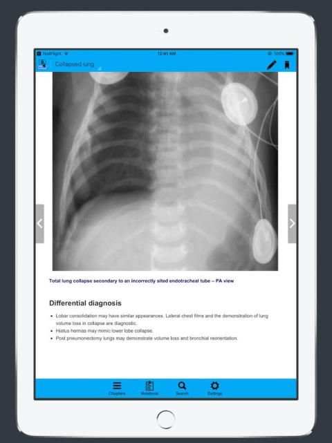 CXR FlashCards - Reference app for Chest X-rays скриншот 3