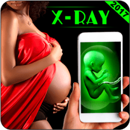 Pregnant Ultrasound Scan Prank иконка