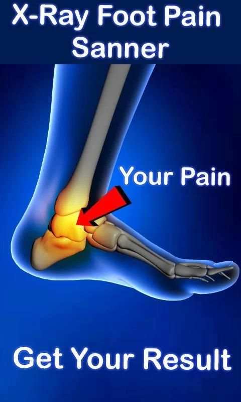 X-ray Foot Pain scanner Prank 2 تصوير الشاشة