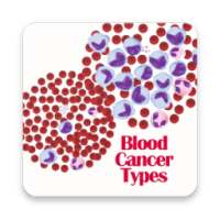 Blood Cancer Types