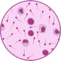 Pyospermia