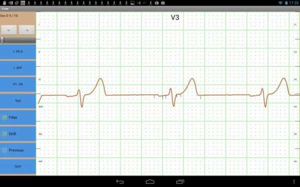 Mobile ecg recording screenshot 5