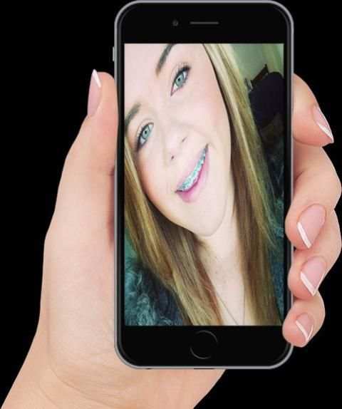 Real Braces teeth Selfie Camer screenshot 5