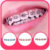 Real Braces teeth Selfie Camer on 9Apps