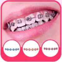 Real Braces teeth Selfie Camer on 9Apps