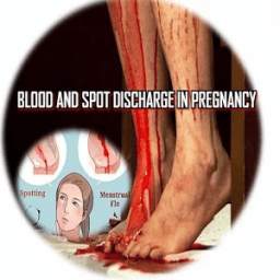 CAUSES OF BLEEDING PREGNANCY