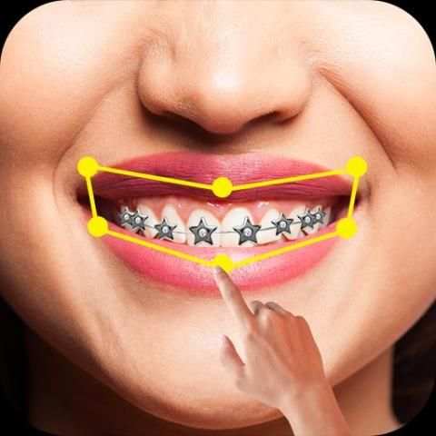 Braces Pro screenshot 4