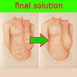 psoriasis solution आइकन