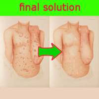 psoriasis solution