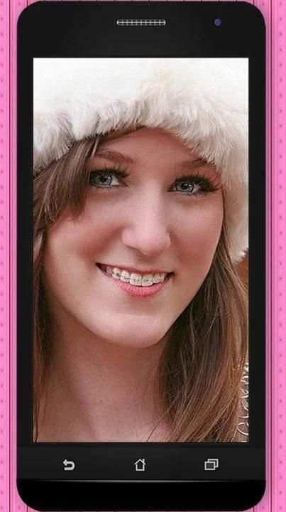 Braces Photos 1 تصوير الشاشة