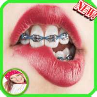 Braces Teeth Booth on 9Apps