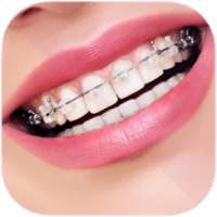 Real Braces Booth Effects on 9Apps