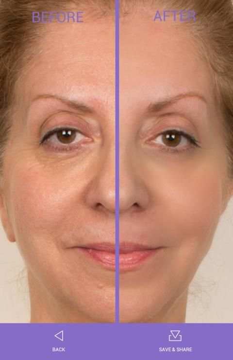FaceLift 1 تصوير الشاشة