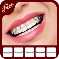 Top Disegn Braces Teeth Camera on 9Apps