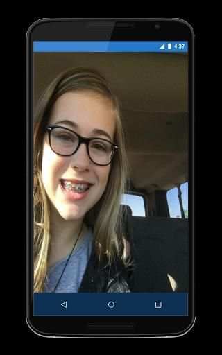 Top Disegn Braces Teeth Camera स्क्रीनशॉट 3
