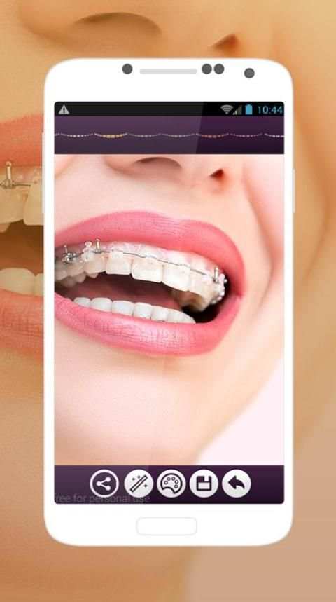 Braces Teeth Photo Editor скриншот 1