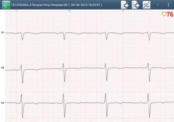 Easy ECG Mobile PRO screenshot 10