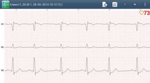 Easy ECG Mobile PRO screenshot 4