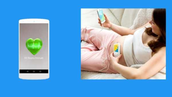 Baby Heart Beat Rate Monitor: During Pregnancy screenshot 3