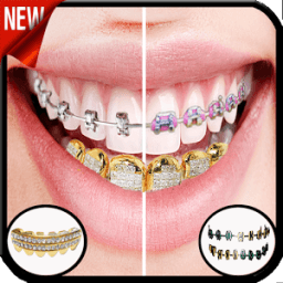 Gold Teeth &amp; Braces photo editor icon