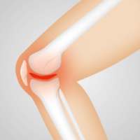 Knee Pain on 9Apps