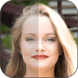 Face Blemishes Removal Photo Editor иконка
