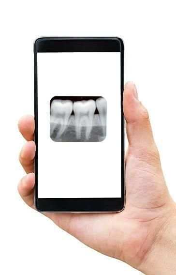 Dent.IN X-RAY screenshot 3