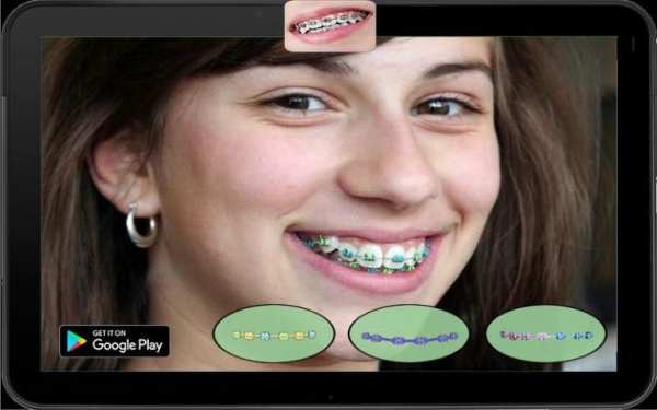 Real Braces Teeth Booth Pro 2 تصوير الشاشة