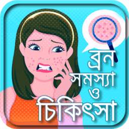 ব্রণ দূর করার উপায় বা skin care beauty tips