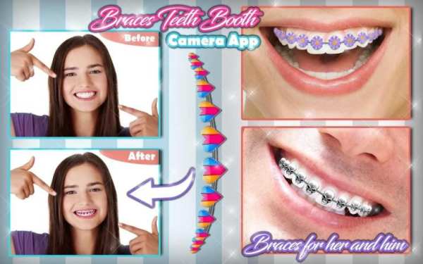 Braces Teeth Booth Camera App screenshot 6