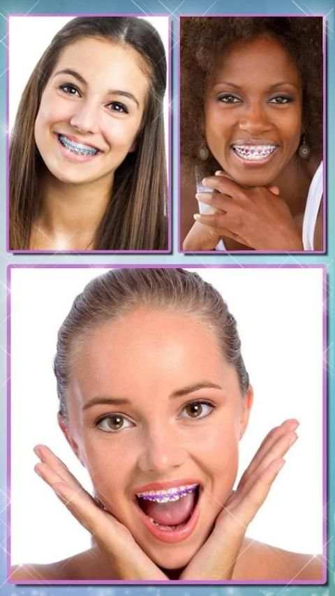 Braces Teeth Booth Camera App screenshot 7