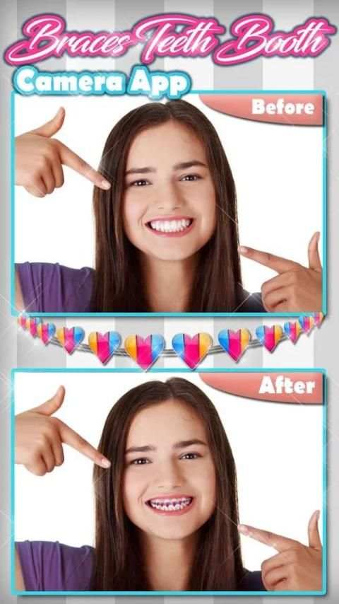 Braces Teeth Booth Camera App screenshot 13