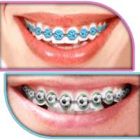 Braces Teeth Booth Camera App on 9Apps