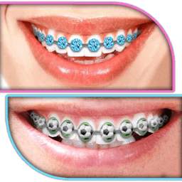 Braces Teeth Booth Camera App 1.0