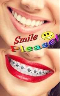 Braces Teeth Photo Maker screenshot 5